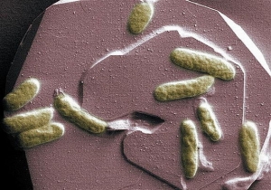 Shewanella oneidensis, проводящие на оболочках клеток микробы (space.com)